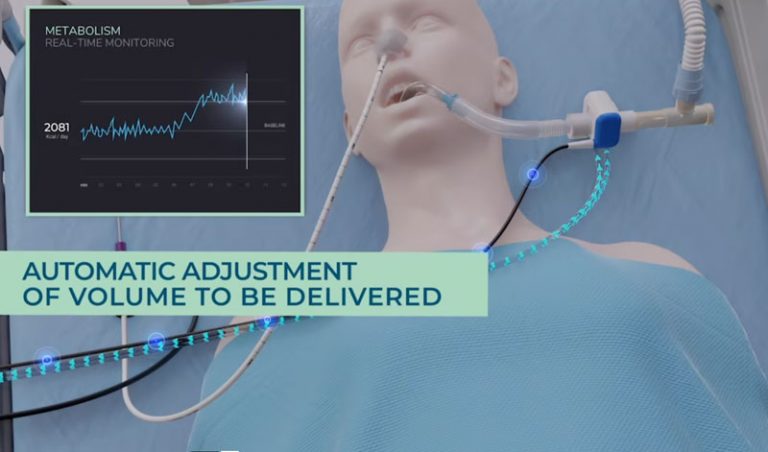Calculating Patient Energy Needs